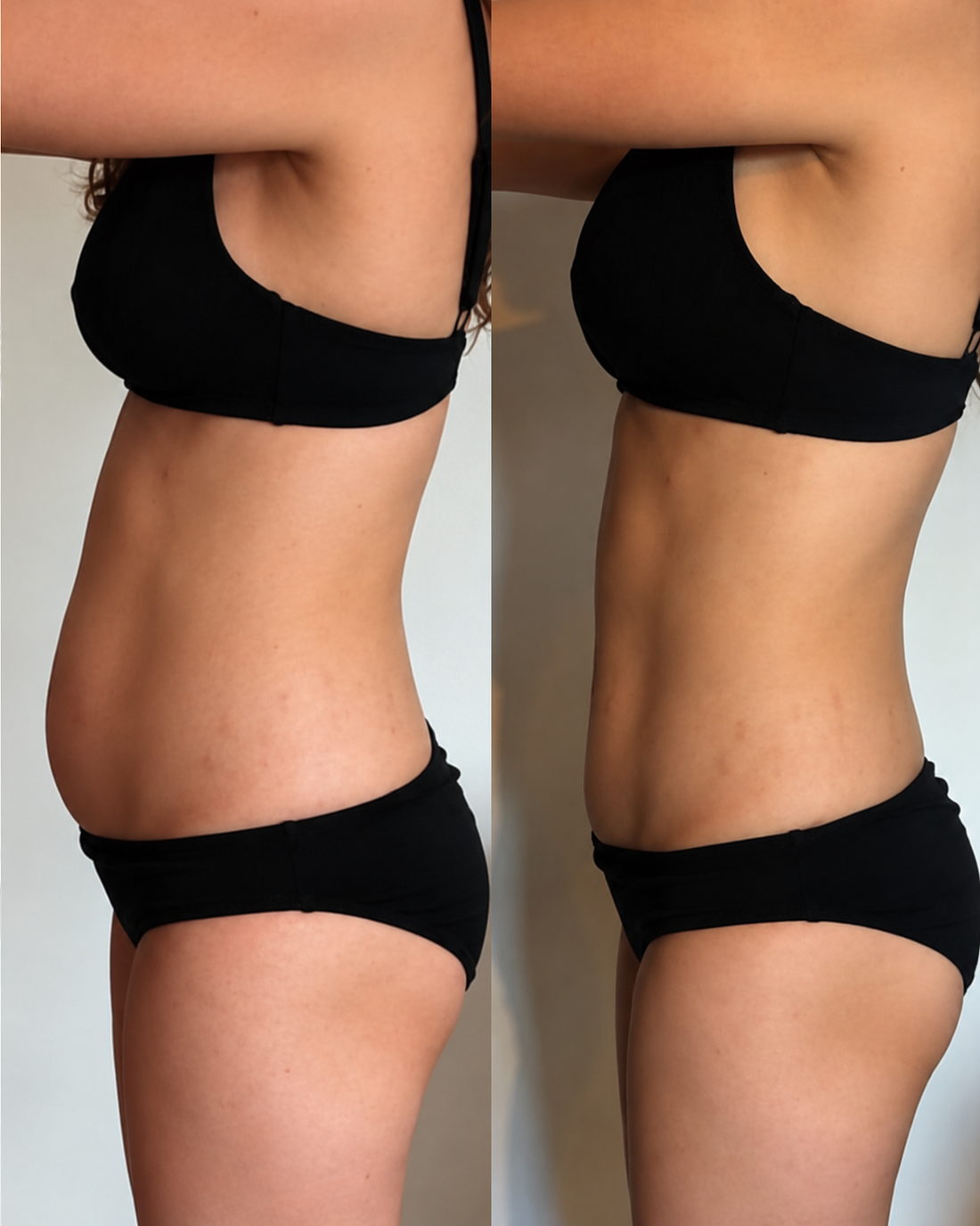 Antes / Después