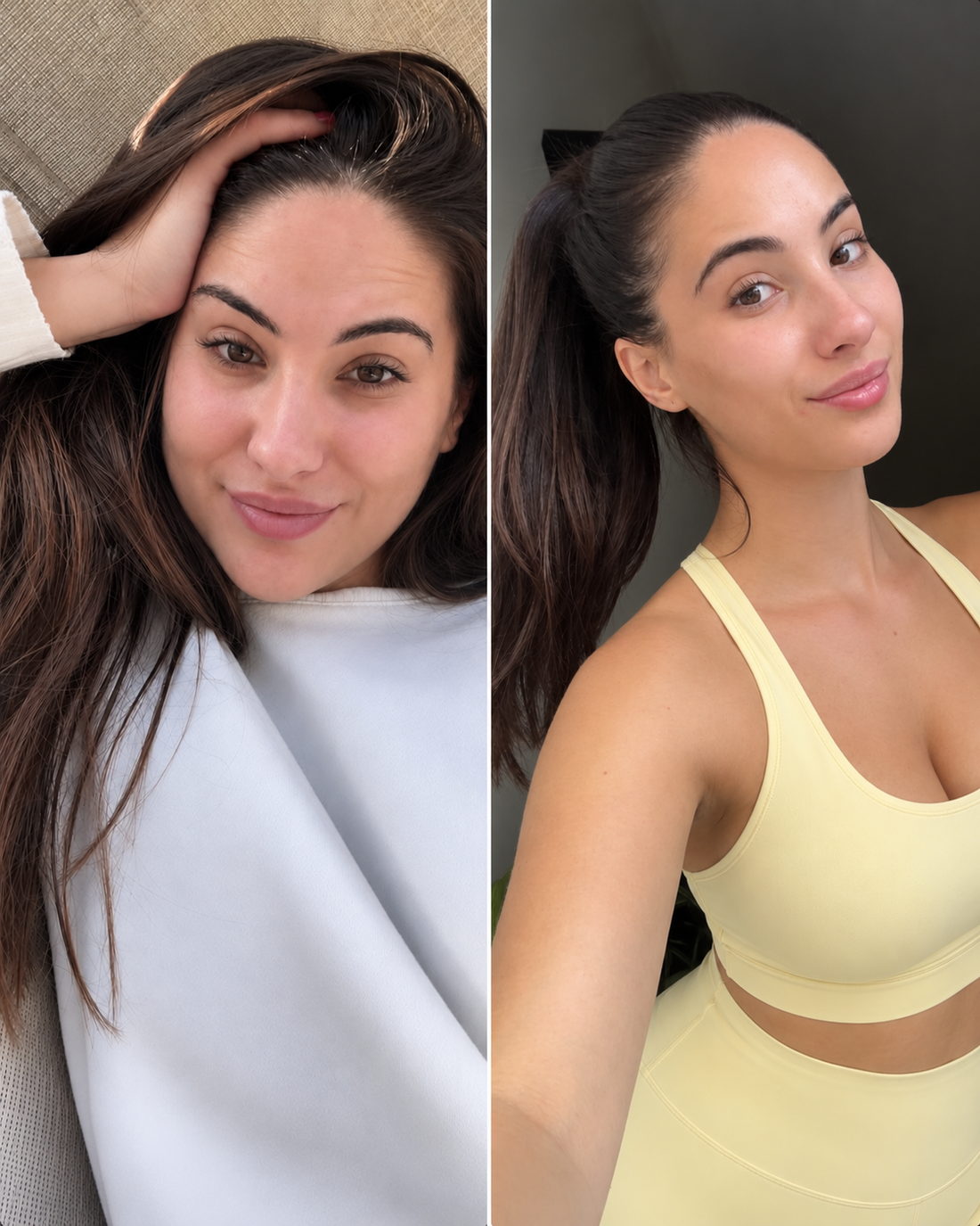 Antes / Después